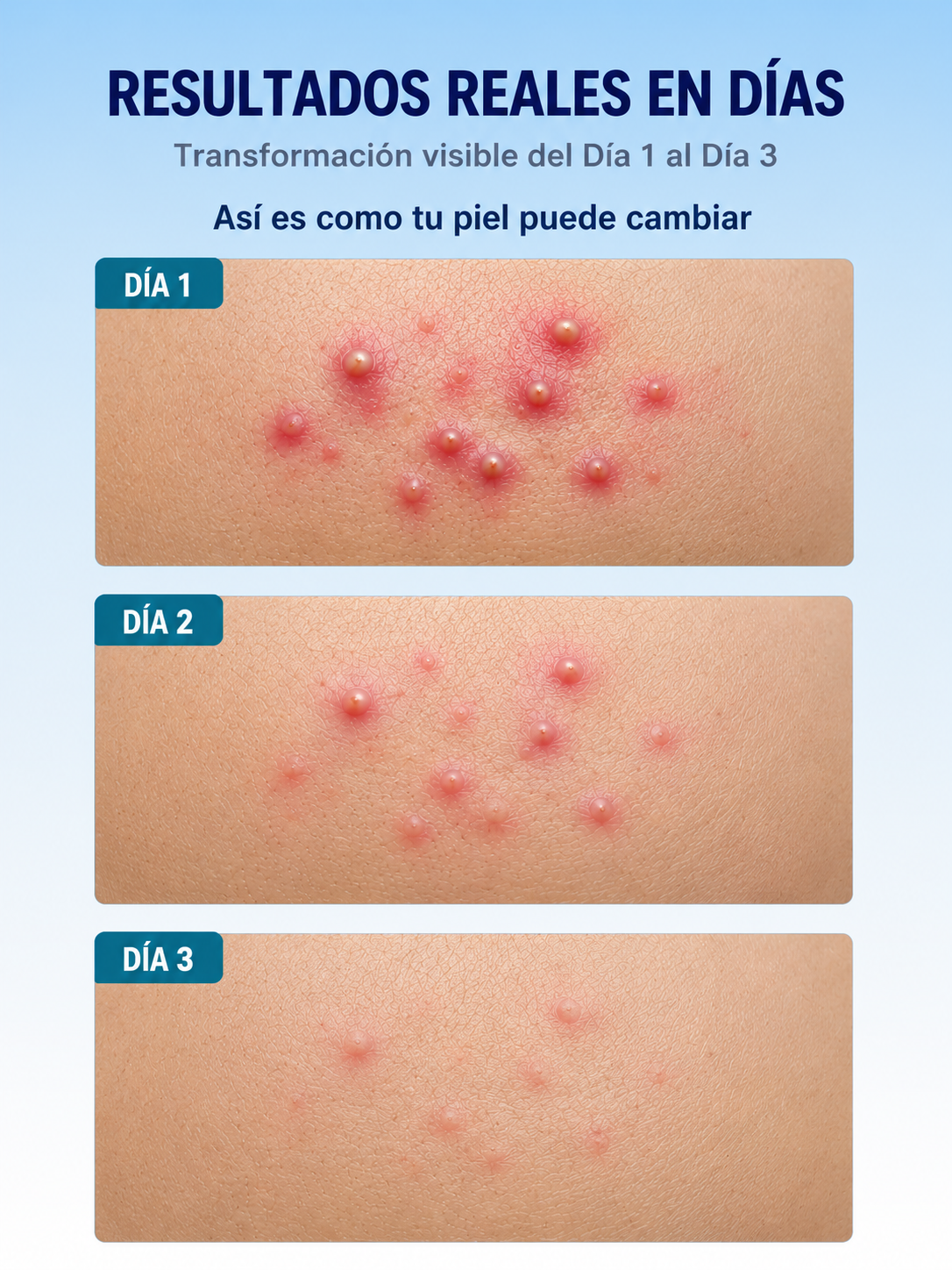 Demunor® Cinta Invisible Hidrocoloide