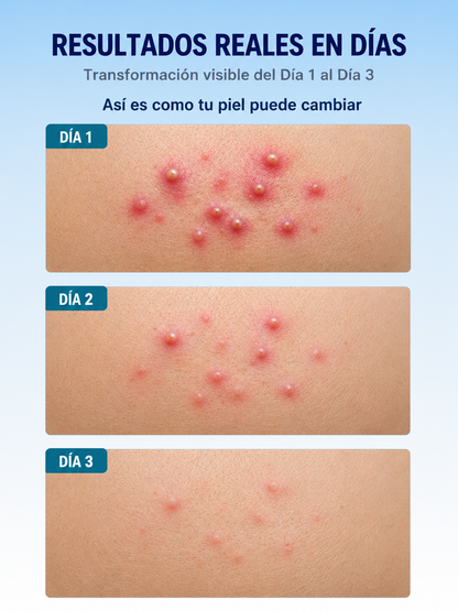 Demunor® Cinta Invisible Hidrocoloide